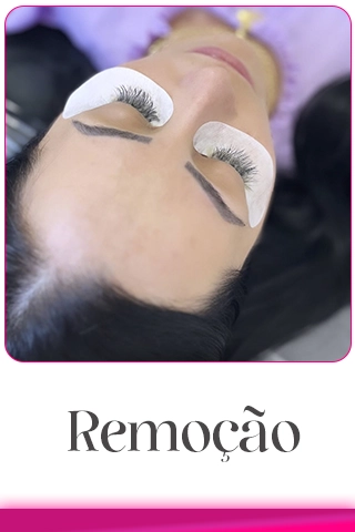 remocao-copiar.webp